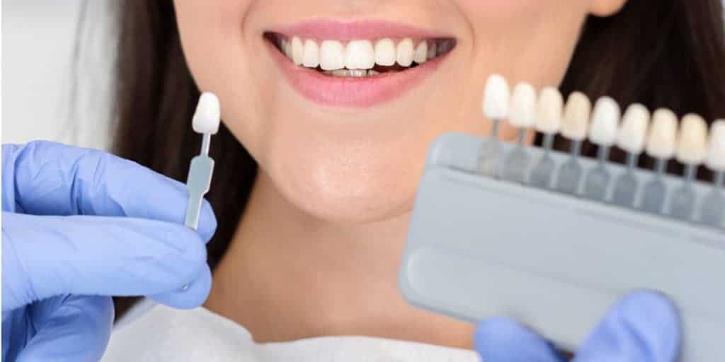 dentist holding tooth shade for veneers - Newmarket Dentists by Oasispark Dental