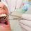 Want A Healthier Smile? Try Newmarket Teeth Cleaning
