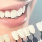 Adding Dental Veneers Newmarket to Your Smile Makeover