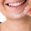 How To Adjust To Your Brand New Invisalign In Newmarket