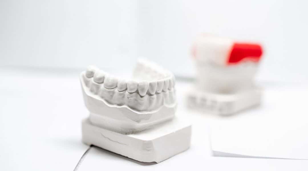dental crowns in newmarket clinic