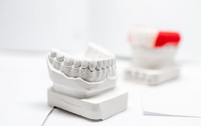 Dental Crowns Newmarket: Procedure, Maintenance, Benefits
