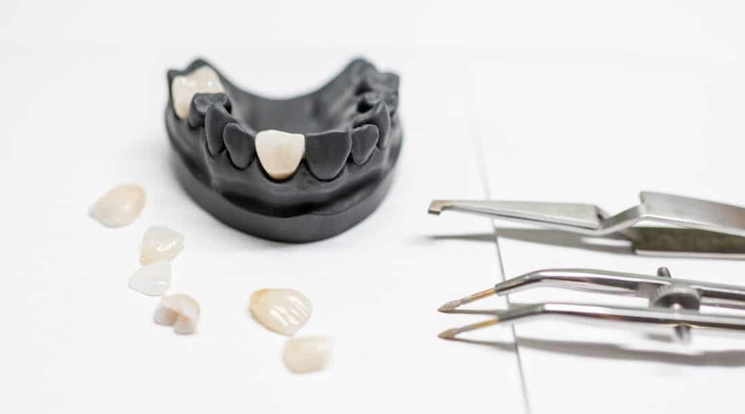 Newmarket dental veneers
