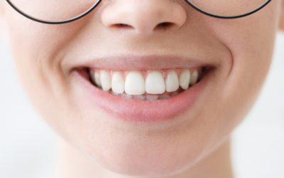 Aesthetic Perfection With Teeth Bonding In Newmarket 