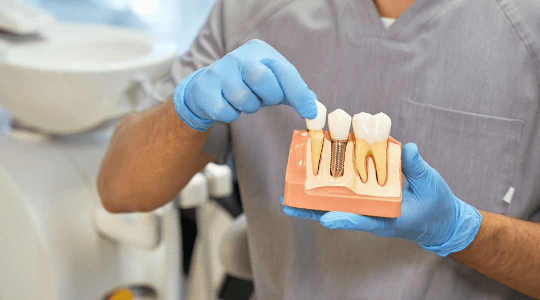 Dental implant procedure in Newmarket office
