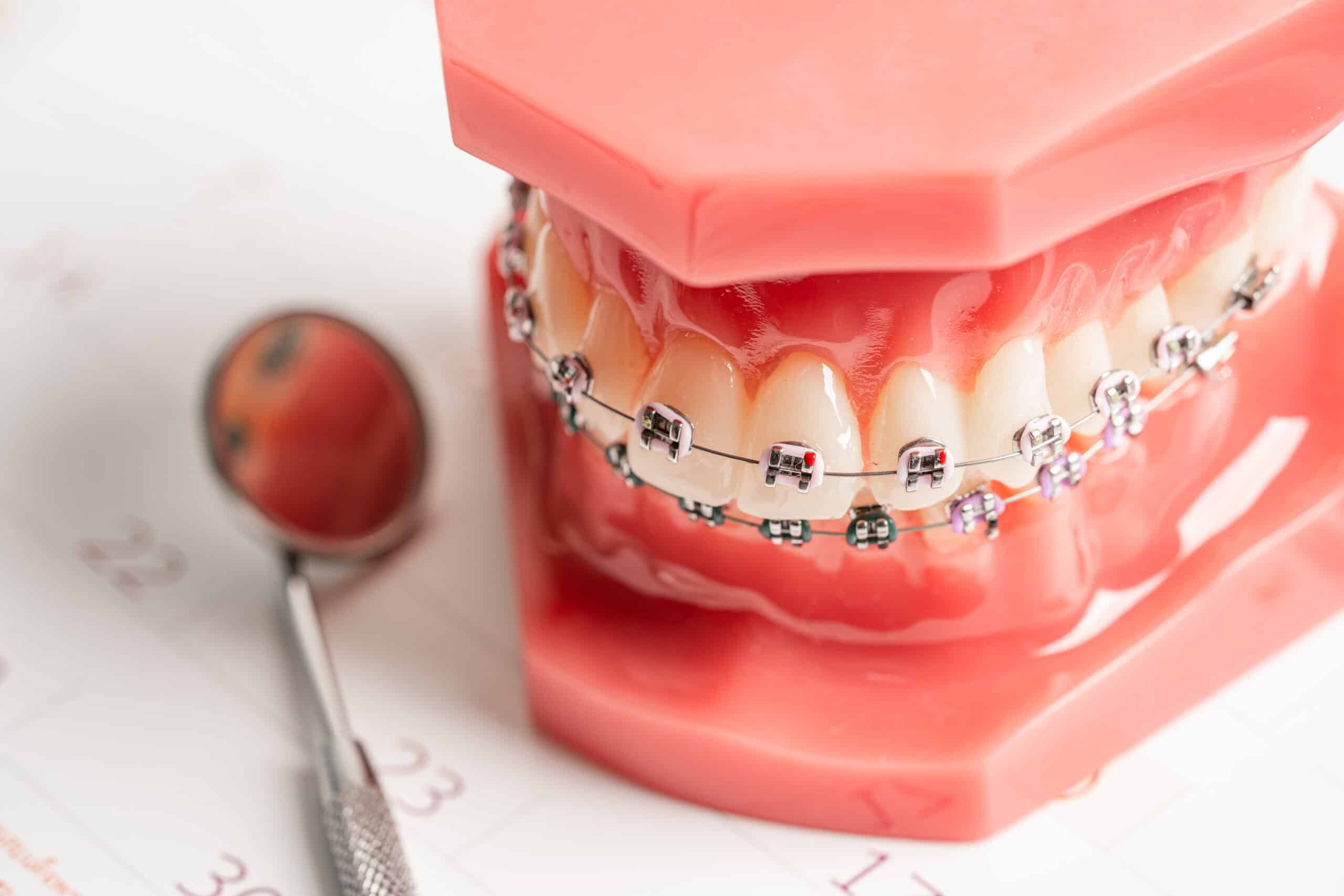 Lady removing wax from metal braces