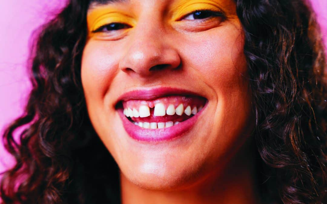 Beyond Braces: 4 Creative Ways To Fix Teeth Gap Without Braces