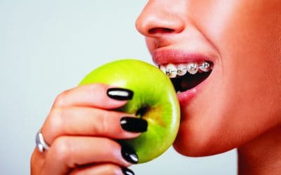 Orthodontics and Diet: What Foods To Avoid With Braces